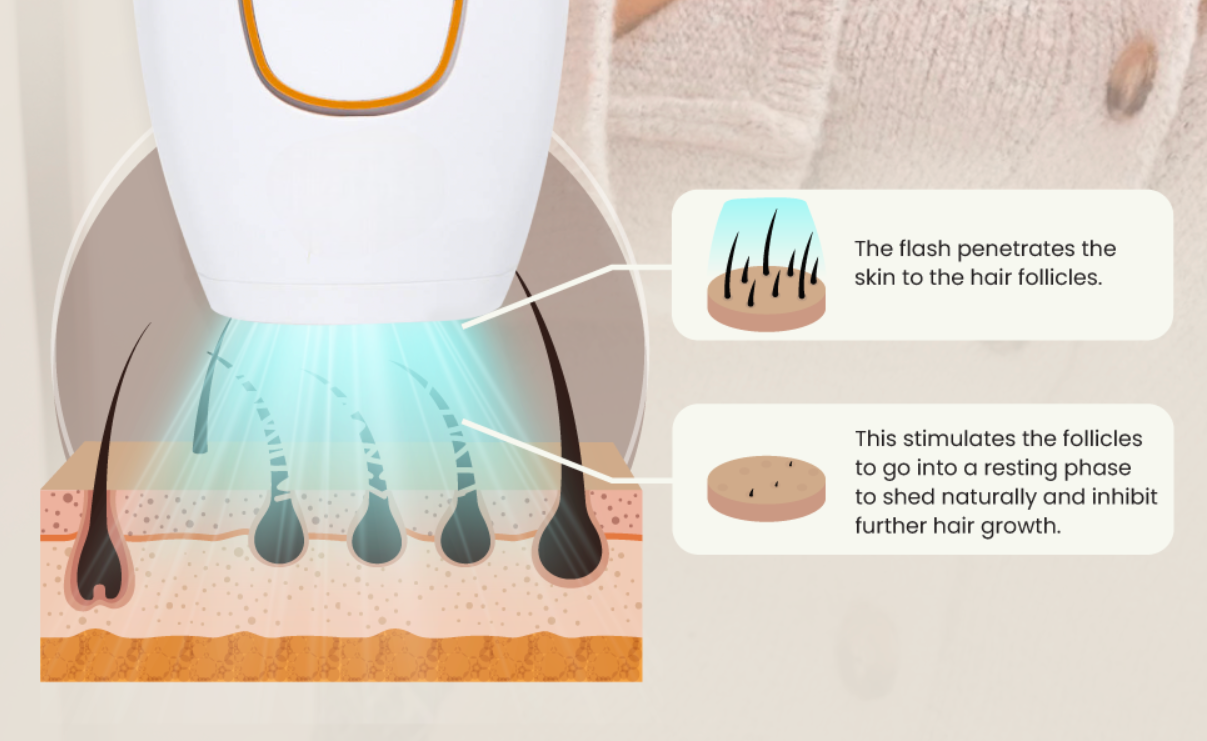 IPL Hair Removal Handset Laser Hair Removal Machine for Permanent Painless Lazer Hair Removing Epilator men and women bikini armpit bikini pubic hair removals